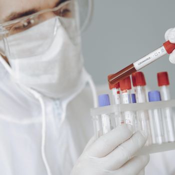 Câmara da Batalha disponibiliza testes ao covid-19 a professores e funcionários de escolas